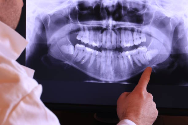 Best Same-Day Emergency Dental Services in Sharon, PA