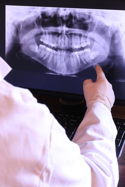 Best Urgent Care for Lost Fillings or Crowns in Sharon, PA