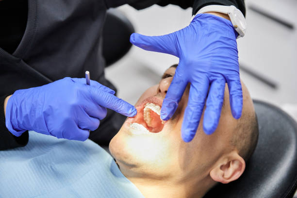 Best Emergency Wisdom Teeth Removal in Sharon, PA